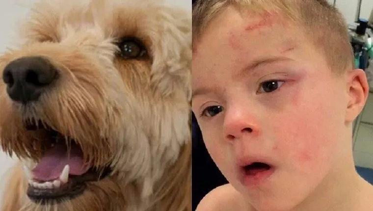 Dogs On Duty: Dog Saves Her Boy With Down’S Syndrome From A Tumble Dryer